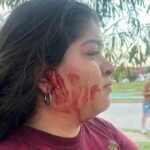 Violento episodio entre trabajadoras de panaderías en barrio Ejército Argentino